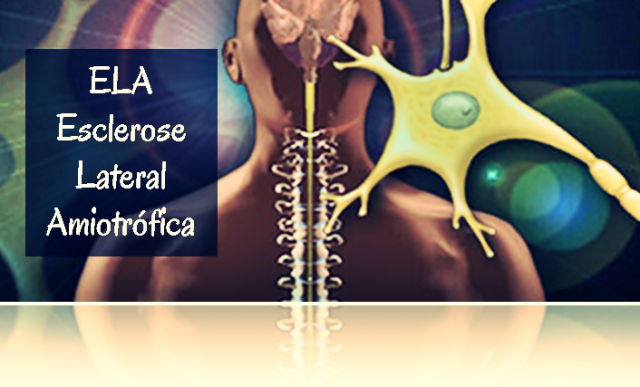 esclerose-lateral-amiotrc3b3fica41