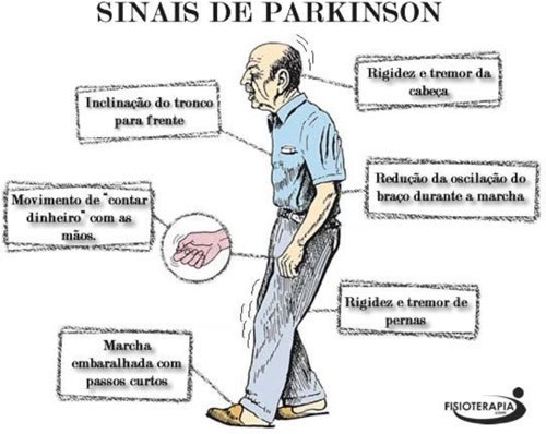 sinais-parkinson